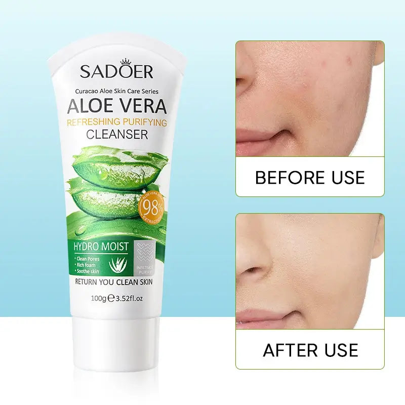 SADOER Aloe Vera Refreshing Purifying Cleanser 98% / Nettoyant Visage Hydratant & Apaisant