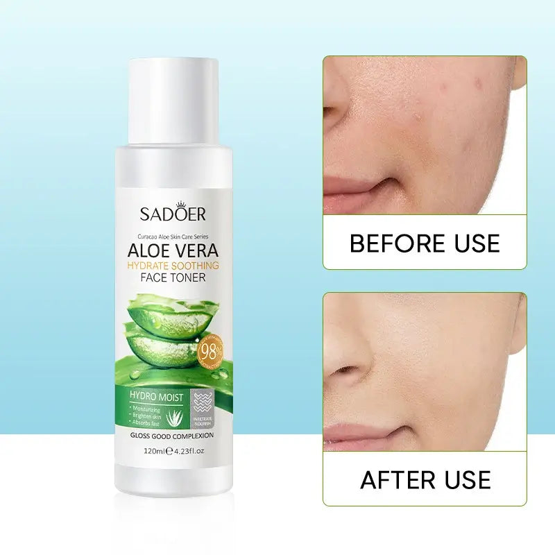 SADOER Aloe Vera Hydrate Soothing Face Toner / Tonique Hydratant & Apaisant 120 ml